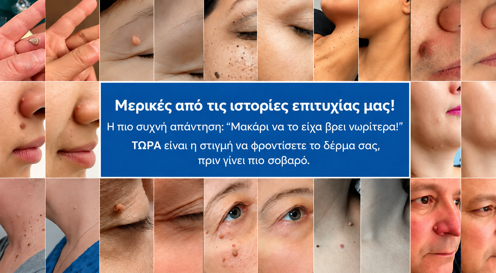 Στοχευμένη φροντίδα για διαφορετικές περιοχές